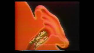 1990s Murine Earwax Removal System Commercial [upl. by Nivets]