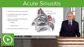 Acute Sinusitis – Infectious Diseases  Lecturio [upl. by Pardo]