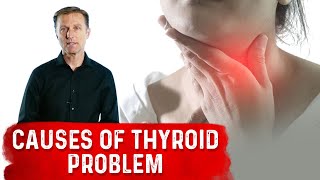 What are the Real Causes of Thyroid Problems – DrBerg [upl. by Kammerer]