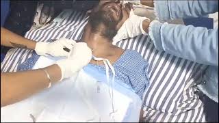 Tracheostomy change in paralysis patientnursing9692883788 [upl. by Neitsabes]