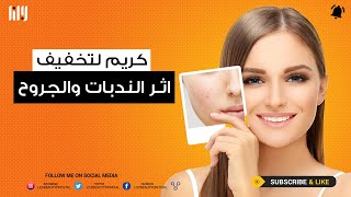 كريم لتخفيف اثر الندبات والجروح [upl. by Occor]