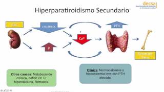 Hiperparatiroidismo [upl. by Nannek616]