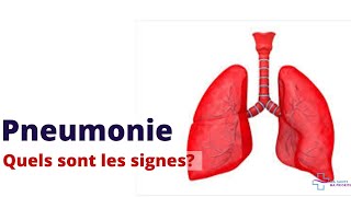 PNEUMONIE QUELS SONT LES SYMPTÔMES D´ALERTE [upl. by Lissie919]