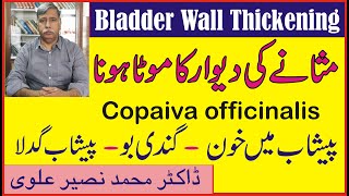 Bladder Wall Thickeningمثانے کی دیوار کا موٹا ہونا۔مثانے کی سوزش ۔ Copaiva officinalis [upl. by Adnamal678]