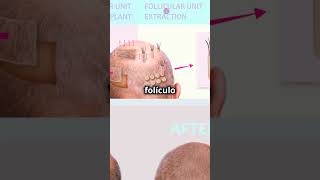 ¡Así crece tu cabello curiosidades datosquenosabias sabiasesto [upl. by Livesay161]