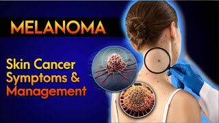 SKIN CANCER AWARENESS  TYPES amp WARNING SIGNSMELANOMASKIN CANCERMELANOMA SYMPTOMSMELANOMA ABCDE [upl. by Adan]