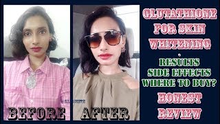 Glutathione Skin Whitening Tablets Results  Genuine Customer Review  SahiJeeth [upl. by Hahnert]