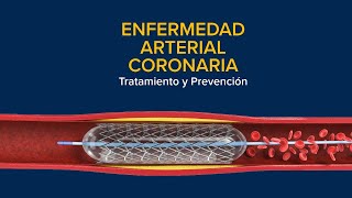 Enfermedad Arterial Coronaria EAC Tratamiento y prevención [upl. by Oluas639]