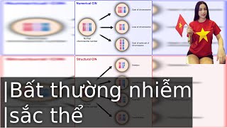 Nguyên Nhân Gây Ra Bất Thường Nhiễm Sắc Thể [upl. by Cleavland604]