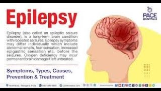 What really causes epilepsy  Symptoms of Epilepsy  Mirgi kya hota h  Mirgi kyu hota h  Hindi [upl. by Mansur]