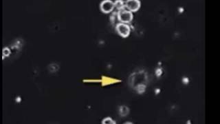 Bacteria Cell cytolysis with video cell division [upl. by Nedla]