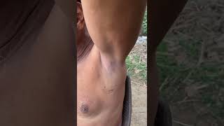 Armpits shaved by easy local barber 💈 armpit hair shave india 🇮🇳 [upl. by Jenkins]