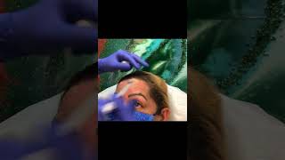 Get Rid Of Forehead Wrinkles At Beverly Hills Wellness Center amp Med Spa Florida shorts [upl. by Elletnahs]