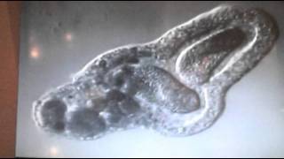 Amoeba eats two paramecia Amoebas lunch [upl. by Meador444]