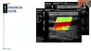 Clase 2  El ABC del Doppler Vascular [upl. by Eladnor]