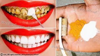 Natural mixtures for yellow teeth whitening at home in 2 minutes without a dentist a proven method💯 [upl. by Patman]