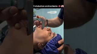 intubation orotrachealeshortsvideo youtubeshorts [upl. by Naes262]