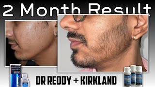 2 Month Beard Growth Result  Minoxidil Beard Journey [upl. by Qahsi]