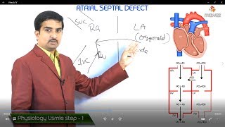 Atrial Septal Defect ASD USMLE Step 1 Pathophysiology [upl. by Lazarus525]