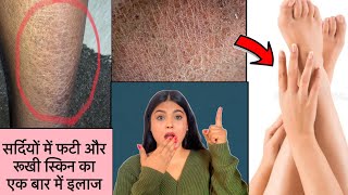 How to repair very Dry and Cracked Skin at Home with Natural Home Remedy [upl. by Airamas]