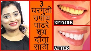 ३ घरगुती उपाय पांढरे शुभ्र दातांसाठी  Top 3 Teeth Whitening Home Remedies in Marathi [upl. by Htebi]