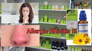 What is Allergic Rhinitis Homeopathic Medicine for Allergic Rhinitis  Health qo [upl. by Eesdnil]