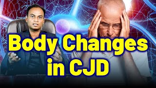 Changes in the body due to CJD Creutzfeldt Jakob Disease Prion Disease Mad Cow CWD [upl. by Poppas]