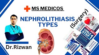 NephrolithiasisSurgeryMS MedicosDr RizwanUrdu Hindi Easy Explanations [upl. by Attenaej]