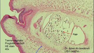 Taenia saginata proglottid cross section [upl. by Buseck758]