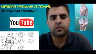 ✅Menisküs Yırtığı ve Tedavisi 🟢 Ameliyat ve MR görüntüleriyle menisküs yırtıkları [upl. by Nami825]