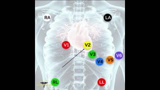 ECG PLACEMENT  12 LEAD ECG [upl. by Saint]