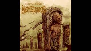 Nasty Surgeons  Exhumation Requiem FULL ALBUM 2017  Death Metal  Goregrind  Deathgrind [upl. by Ylle]