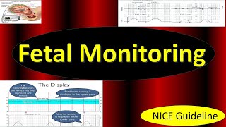 Fetal Monitoring in Labor NICE Guideline 2022  Updates in Cardiotocography CTG [upl. by Urson]