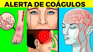 7 síntomas SILENCIOSOS DE COÁGULOS EN LA SANGRE RIESGO Y CUANDO IR AL DOCTOR [upl. by Ednutey124]