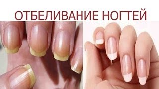 ОТБЕЛИВАНИЕ НОГТЕЙ nail care в домашних условиях [upl. by Fiann520]