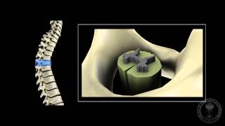 Neuroanatomy  The spinal cord [upl. by Ahsenrad]