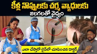 DrShanti Swaroop About Leech Treatment  Knee Pains  Leech Therapy for Skin  SumanTV Telugu [upl. by Clarisse240]