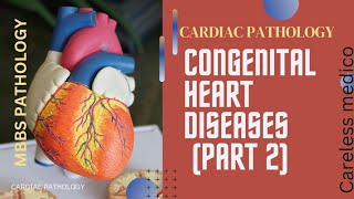 CARDIAC PATHOLOGY CONGENITAL HEART DISEASES part2 lecture15 pathology robbins pathoma mbbs [upl. by Derrik]