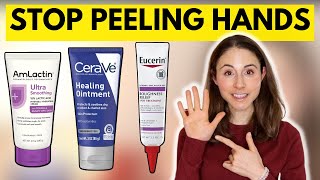 How to STOP SKIN PEELING ON THE HANDS amp FEET 🤔 Dermatologist DrDrayzday [upl. by Ttessil460]