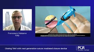 Closing TAVI with next generation suture mediated closure device  PCR London Valves 2021 [upl. by Bordy227]