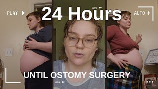 24 Hours Until Ostomy Surgery  Ostomy Countdown [upl. by Eugenides294]