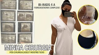 MINHA CIRURGIA FIBROADENOMA COMPLEXO BIRADS 4A MAMA mostrei meu pós cirúrgico [upl. by Alverson862]