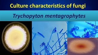 Trychopyton mentagrophytesDermatophytes you must know [upl. by Safir]