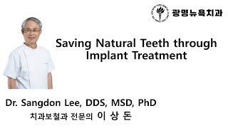 Saving Natural Teeth through Implant Treatment [upl. by Anidnamra]