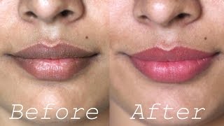 How to Lighten Dark Lips Naturally  Rapid Home Remedies [upl. by Rimhsak]