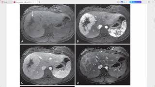 FUNDAMENTALS OF BODY MRI [upl. by Annoyed]