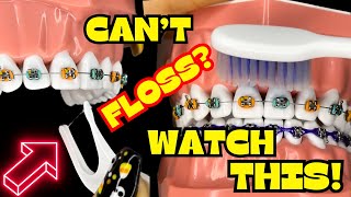 How to BRUSH and FLOSS your TEETH with BRACES ON  TUTORIAL   BRUSHING  FLOSSING [upl. by Sug]