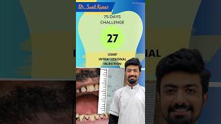 2775 Days Challenge 75dayshardchallenge dentist singledaydentistry dentalclinic [upl. by Crooks898]