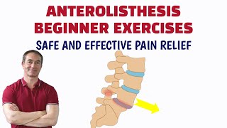 Lumbar Anterolisthesis Exercises [upl. by Guglielma41]