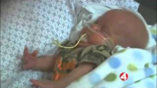 Childrens Hospital Oakland  Pediatric Neonatology pt 1 [upl. by Ahsikcin]